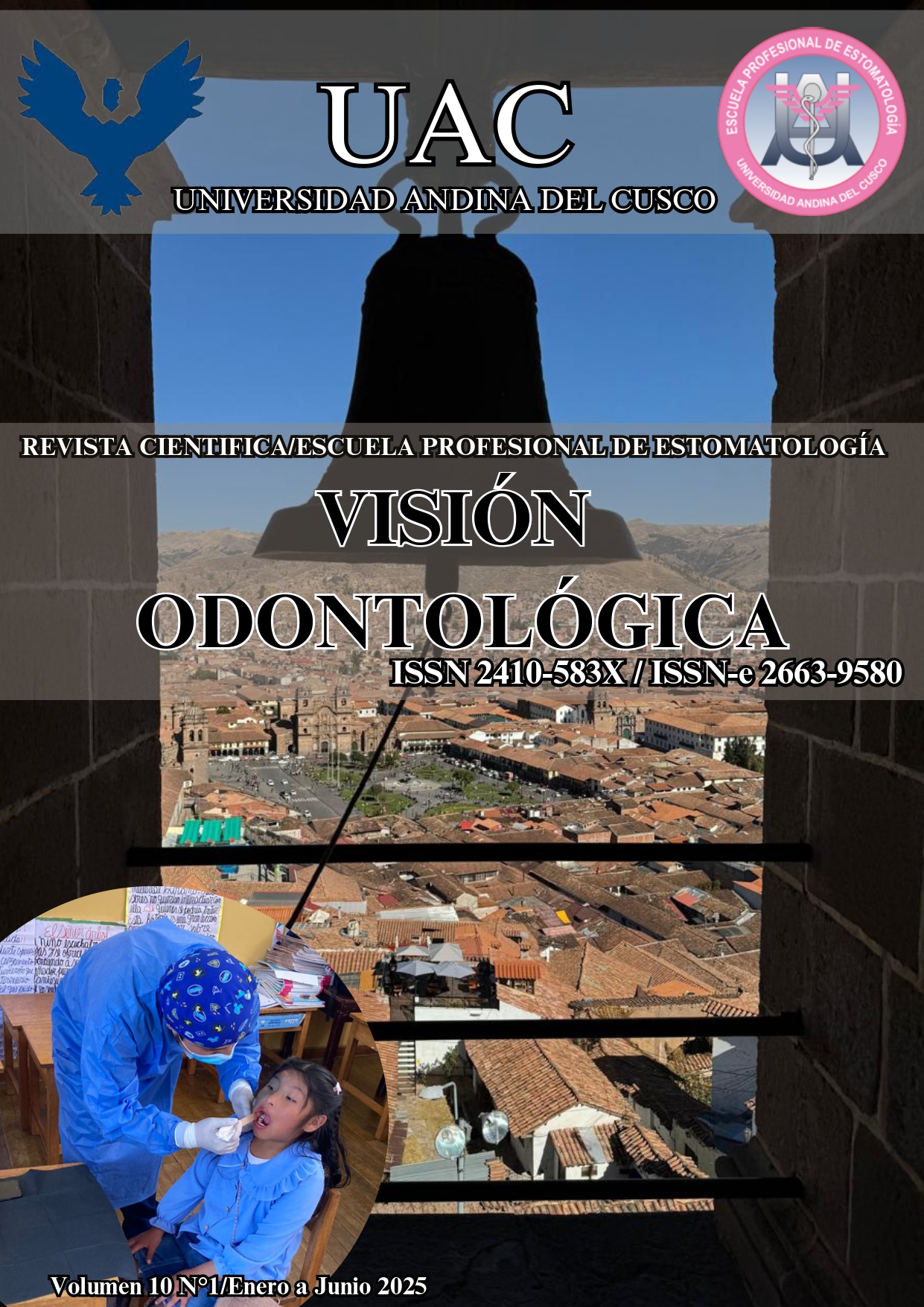 					Ver Vol. 10 Núm. 1 (2025): Vision Odontologica
				